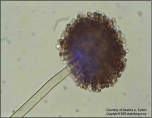 Aspergillus